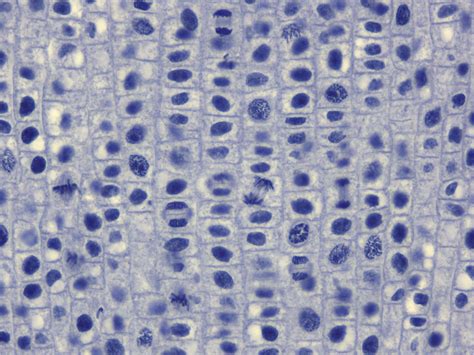 MR002 - Mitosis, Onion Root Tip - Valley Microscope