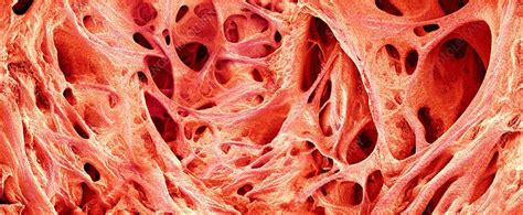 Trabeculae carneae in the heart, SEM - Stock Image - C019/4770 - Science Photo Library