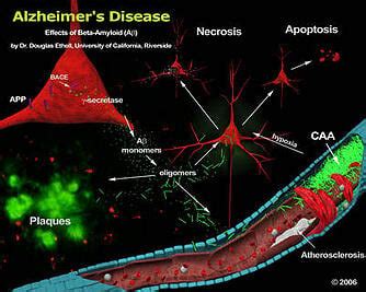 Biomedical Science Researchers at UCR Find Alzheimer's Breakthrough