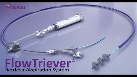 Inari Medical FlowTriever Retrieval/Aspiration System - YouTube | Inari ...