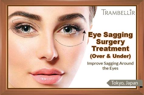 Eye Sagging Surgery Treatment (Improve Sagging Around the Eyes) | Trambellir