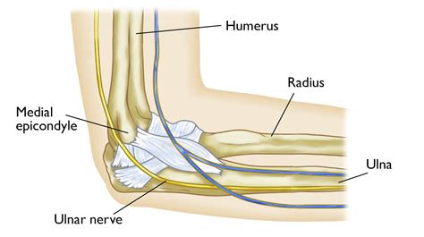 Ulnar Nerve Entrapment at the Elbow (Cubital Tunnel Syndrome ...