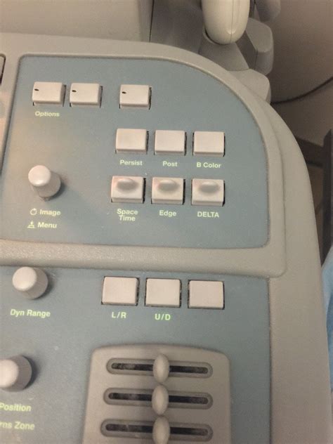 My doctor's ultrasound machine controls space-time : mildlyinteresting