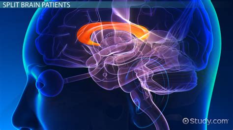 What is Corpus Callosum? - Definition, Function & Location - Video & Lesson Transcript | Study.com