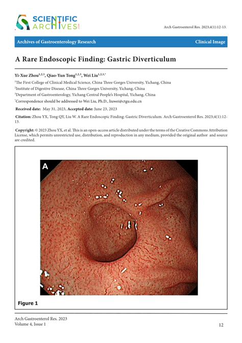 (PDF) A Rare Endoscopic Finding: Gastric Diverticulum