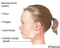 Lymph Node Behind Ear - Vital Pieces of Lumps on Neck Lumps on Neck Secrets ... / But with ...