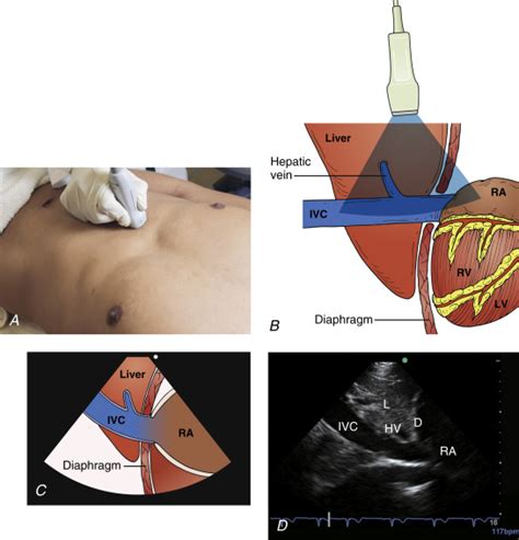 Cardiac Ultrasound Technique | Radiology Key