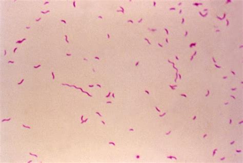 Foodborne Pathogens | Fight Bac!