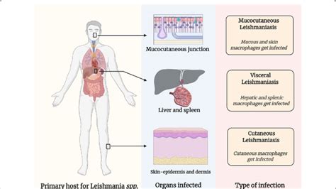 Types of leishmaniasis and the organs affected; Mucocutaneous ...