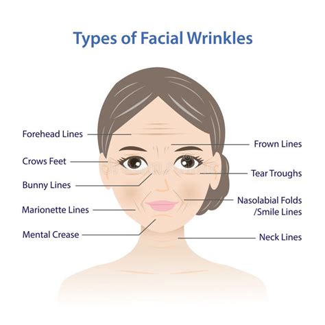 Types of Facial Wrinkles on Woman Face Vector Illustration Isolated on ...