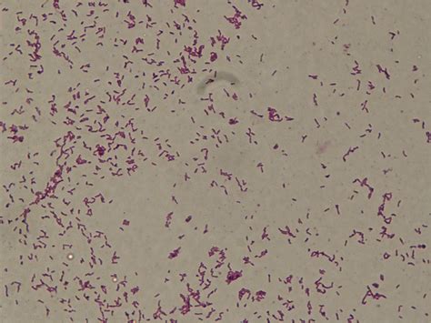 Gram stain picture of Corynebacterium diphtheriae showing Gram-positive... | Download Scientific ...