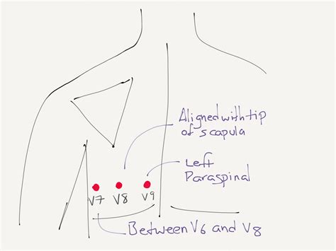 v7 v8 v9 lead placement - lineartdrawingstattoo