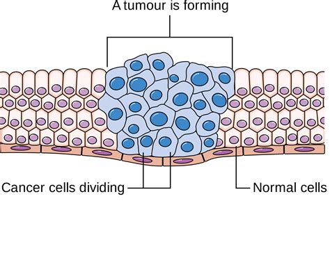 Cancer Breakthrough: Scientists Find Way To Possibly "Turn-off Cancer" - Complete Wellness Report