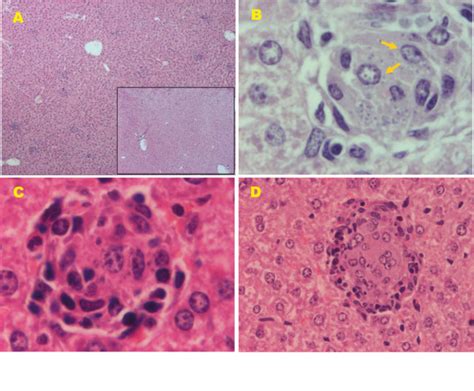 The liver granuloma reaction after L. infantum infection. (A) The ...