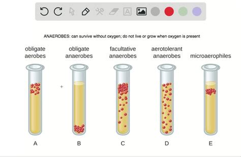 SOLVED: Which of the following terms best describes an organism that camnot exist in the ...