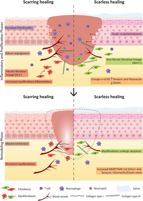 Frontiers | A Scarless Healing Tale: Comparing Homeostasis and Wound ...