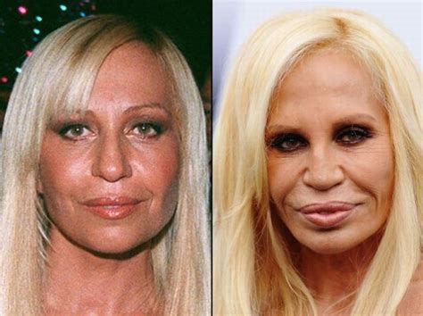 Celebrities Before and After a Plastic Surgery (21 pics)