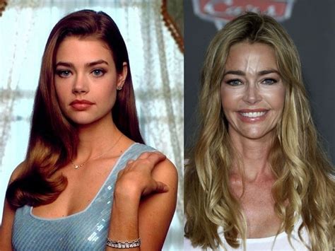 Denise Richards Before and After Plastic Surgery: boob, face