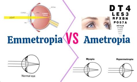 EMMETROPIA and AMETROPIA - Optography