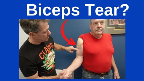 Biceps Tendon Rupture-Signs and Symptoms - YouTube