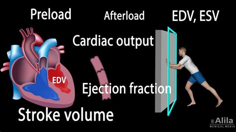 Cardiac Output, Stroke volume, EDV, ESV, Ejection Fraction - YouTube