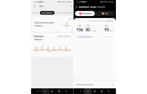 ECG and blood pressure monitoring finally live for Galaxy Watch Active2 ...