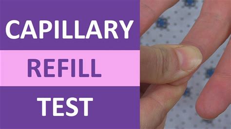 Capillary Refill Time Test: Normal vs Abnormal - Nursing Clinical Skills - YouTube