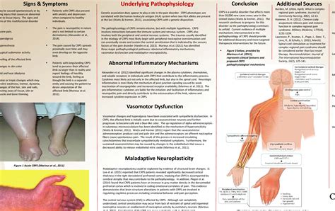 Complex regional pain syndrome. | Semantic Scholar