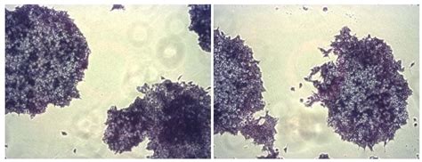 Alkaline Phosphatase Staining Kit (Purple) (ab242287) | Abcam