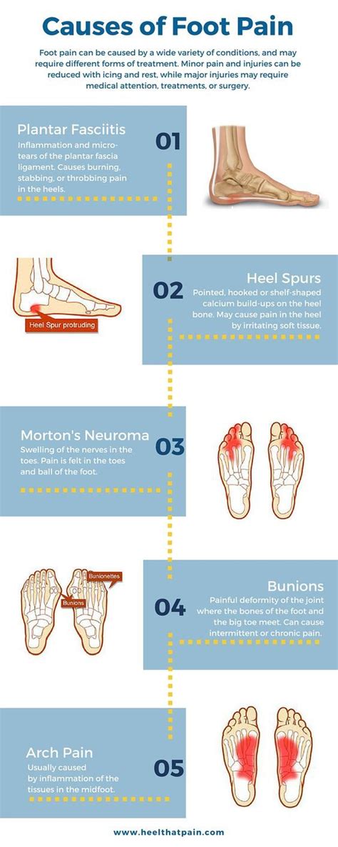 Foot pain chart: Do you know what's causing your foot pain? It may be one of a number of ...