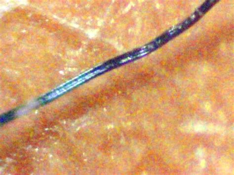 Morgellons Synopsis of Fiber Specimens