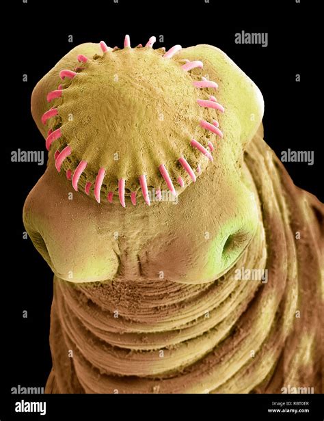 Tapeworm Under A Microscope