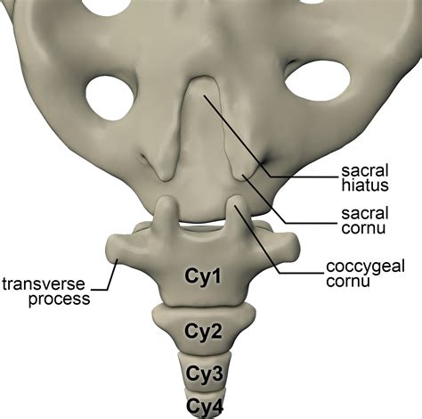 Imaging Coccygeal Trauma and Coccydynia | RadioGraphics