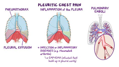 Lung Anatomy Pleura