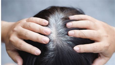 After Surgery Hair Loss: Causes and Solutions