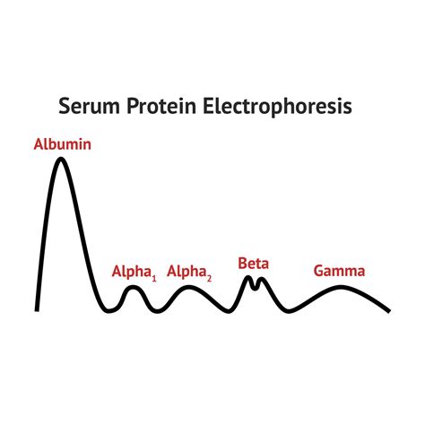 Serum Protein Electrophoresis | Serum, Medical laboratory technician ...