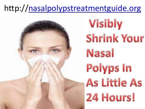 Nasalpolyps treatment guide