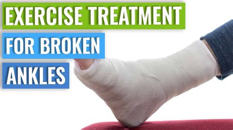 Ankle Fracture Treatment - Recovery Time & Exercises - YouTube