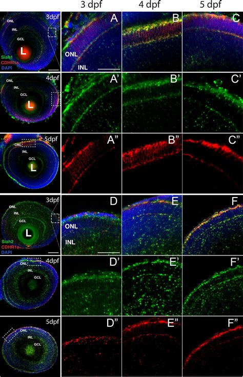 Frontiers | Proteasome-Mediated Regulation of Cdhr1a by Siah1 Modulates Photoreceptor ...