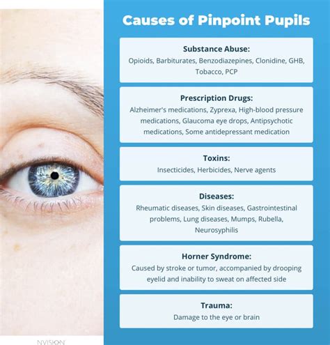 Why Do I Have Pinpoint Pupils? 6 Causes – NVISION