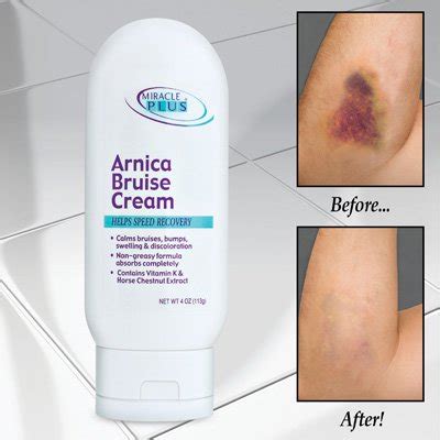 Arnica Bruise Cream - Walmart.com - Walmart.com