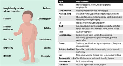 Mitochondrial disease in children - Rahman - 2020 - Journal of Internal ...