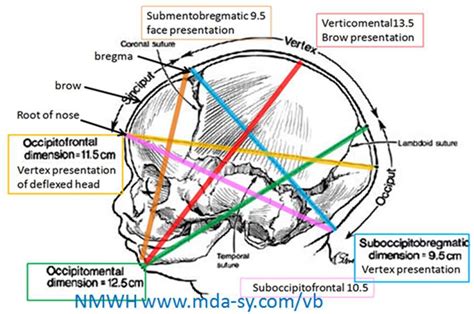 STUDY WITH FUN: diameters of fetal skull