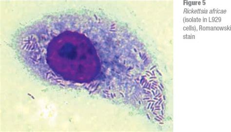 Rickettsia Prowazekii Under A Microscope