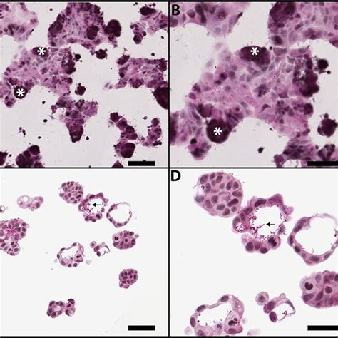 Morphology of MCF-7 cells grown in 2D and 3D cultures. MCF-7 human ...