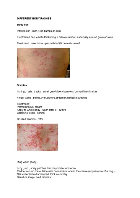 Different BODY Rashes - body rash summary for OSCE - DIFFERENT BODY ...