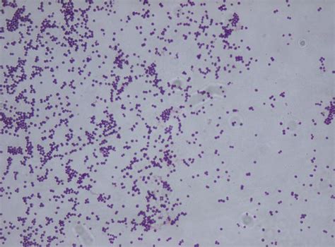 Staphylococcus saprophyticus gram stain | Medical Laboratories