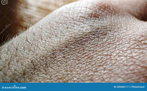 Human Skin Texture. Macro Healthy and Young Hand Skin Stock Image - Image of background, body ...