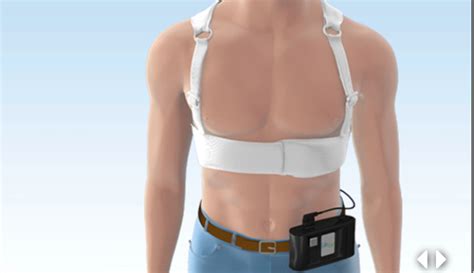 Study: Wearable defibrillators don't work unless you wear them ...