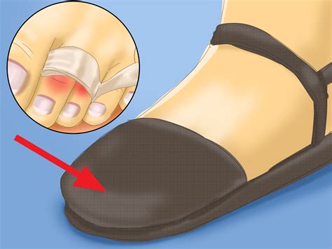 How to Buddy Tape an Injured Toe: 7 Steps (with Pictures)